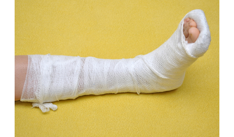 New mechanism helps bone cells regenerate in fractures