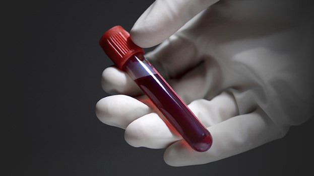 Blood Test Can Predict if You Need Antibiotics