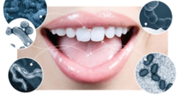 Oral bacteria may be linked to esophageal cancer: Study