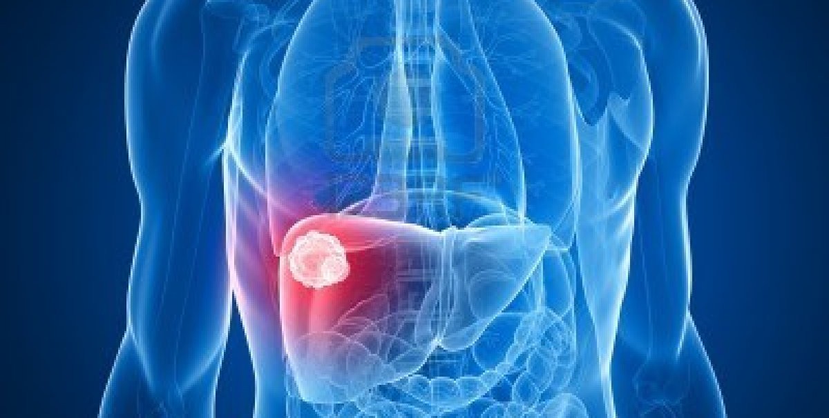 New tool can pinpoint life-threatening liver disease