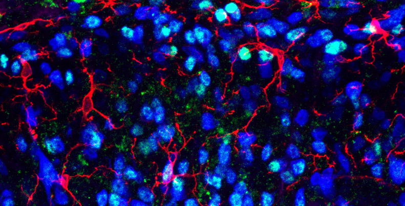 Blocking Stress Protein Relieves Chronic Pain