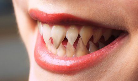 Humans May One Day Grow New Teeth Like Sharks