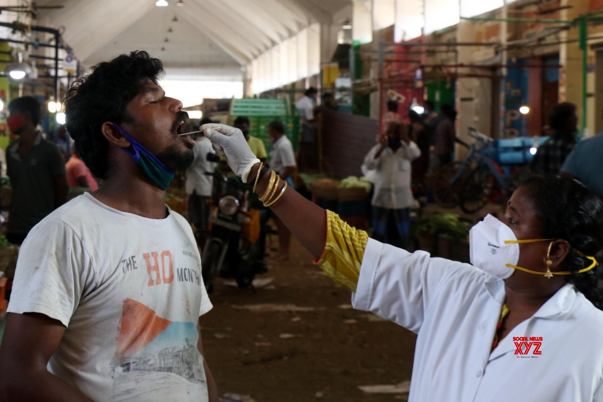 Andhra's active caseload soars to over 73K Andhra's active caseload soars to over 73K