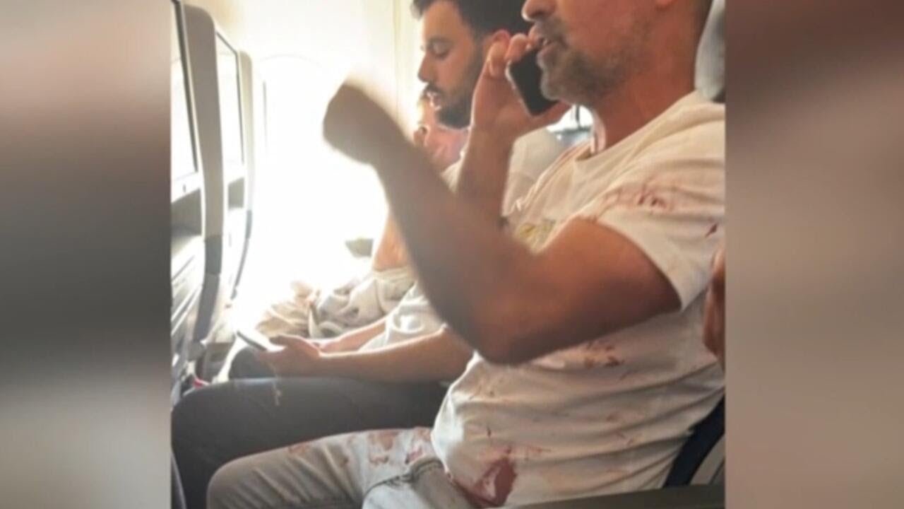 Alleged pilot stabbing aboard Israel-bound flight investigated as possible terrorism (Video)