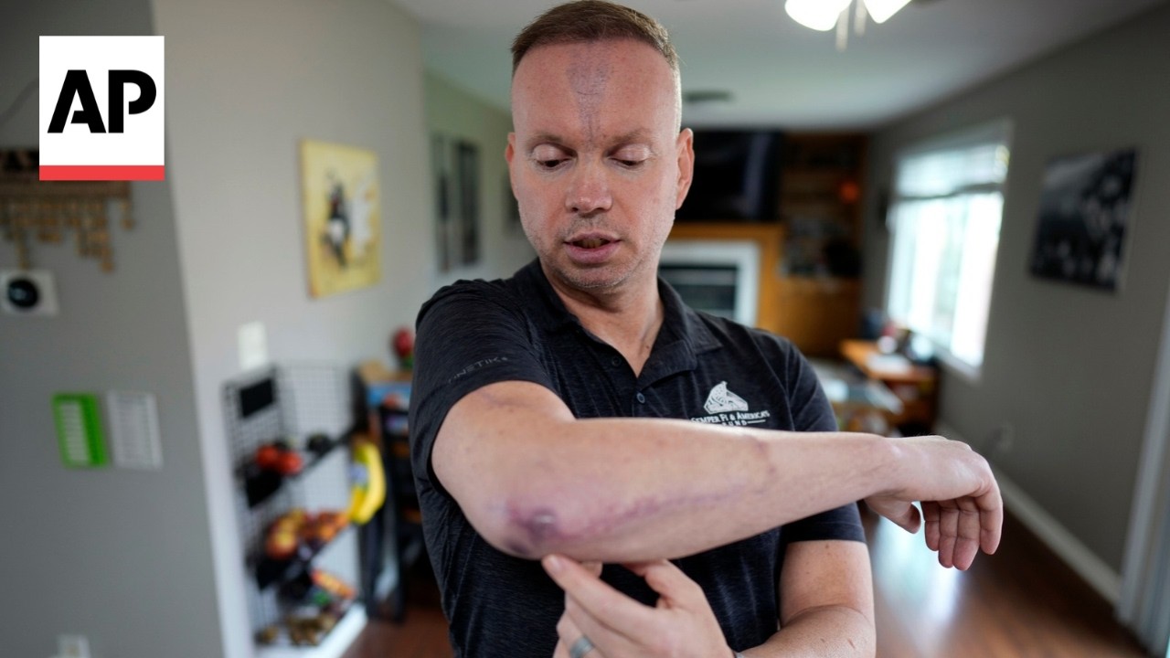 Soldier injured in Iran attack says troops had to use Google to find the nearest hospital (Video)