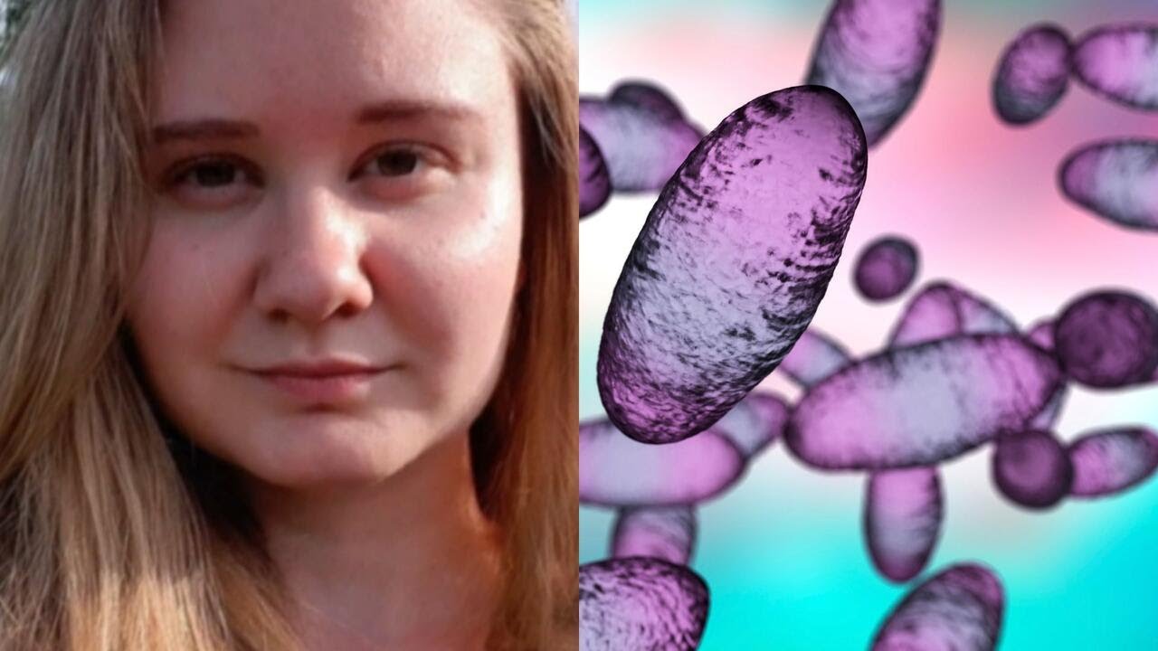Russia downplays plague fears after lab researcher's death (Video)