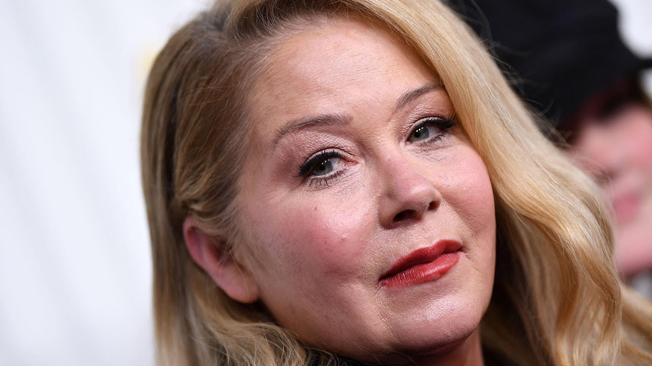 Doctor explains how a misdiagnosis of multiple sclerosis happens amid Christina Applegate news (Video)